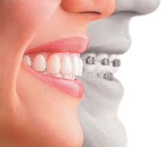 removable appliances Surgery saravana dental clinic thiruthuraipoondi and vedaranyam